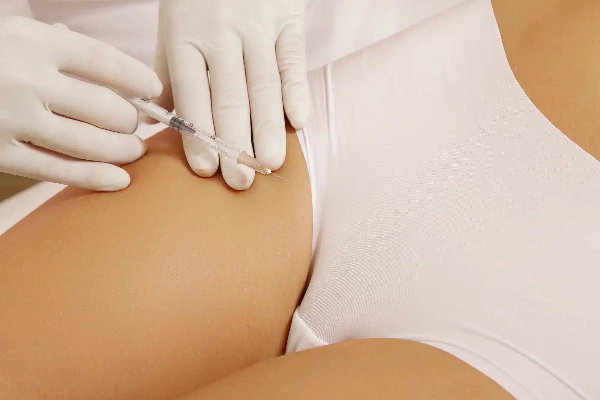 Büyük Dudak Dolgunlaştırma